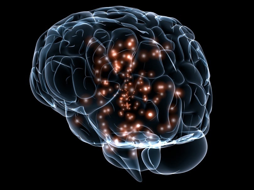 brain image